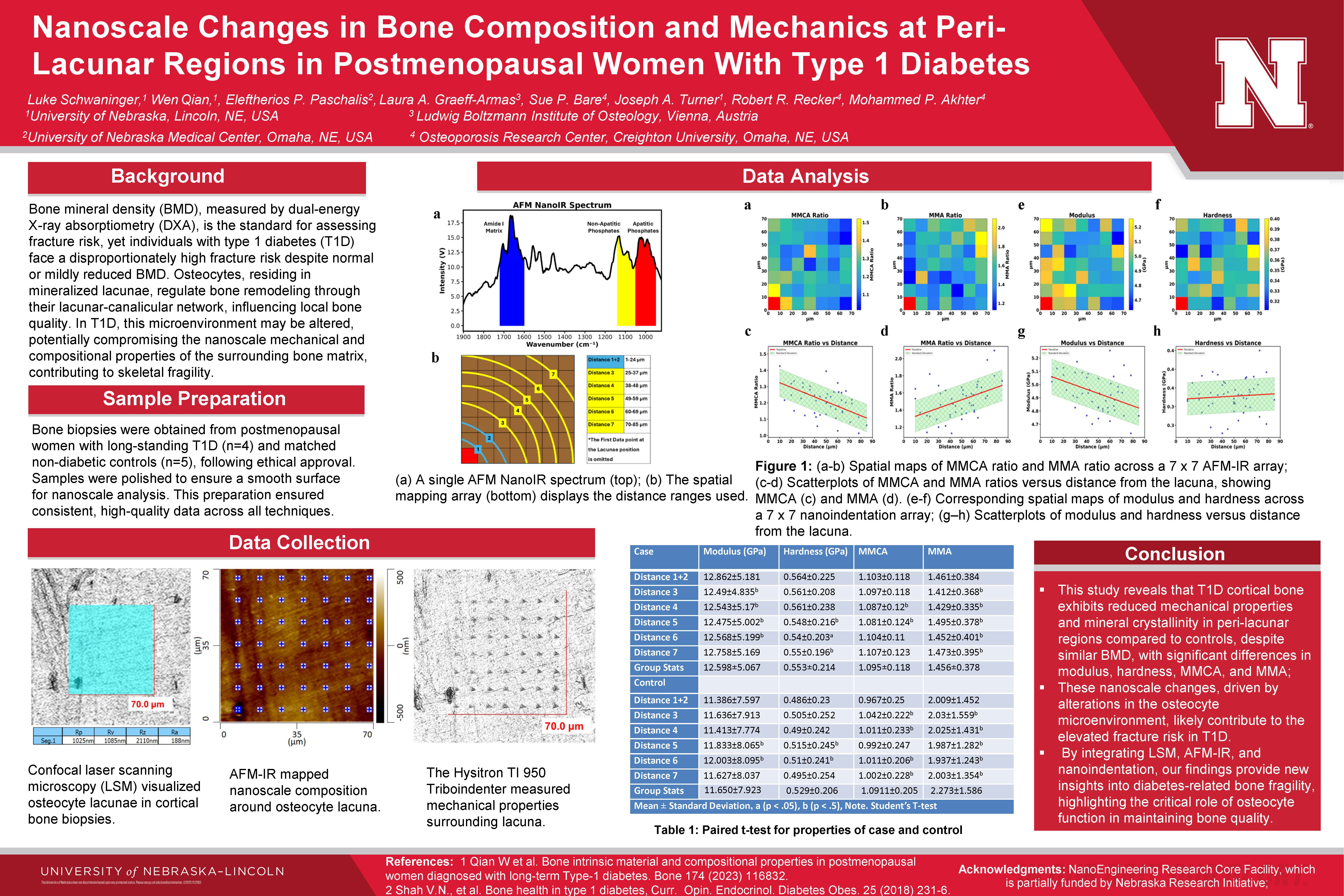 Bones Poster